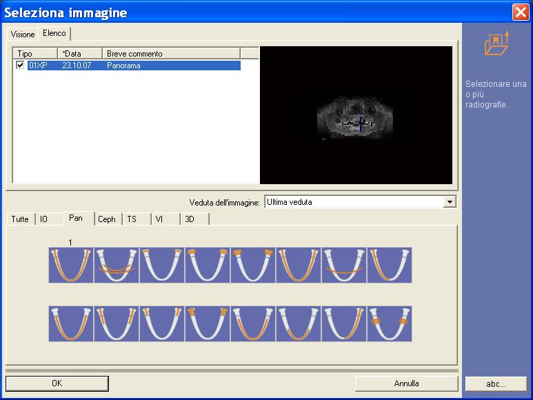 3 Uso 3.5 Gestione delle immagini 3.5.3.1 Struttura della finestra di dialogo Finestra di dialogo Struttura della finestra di dialogo Scheda delle viste Sono disponibili due diversi tipi di schede