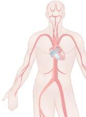 ARTERIE COLPITE OVERVIEW RIASSUNTIVA PATOLOGIE CONSEGUENTI ALLA PROGRESSIONE DELL ATEROSCLEROSI TIPI DI MANIFESTAZIONE CLINICA IN RELAZIONE AL GRADO DI STENOSI E ALL ARTERIA COLPITA GRADO DI STENOSI