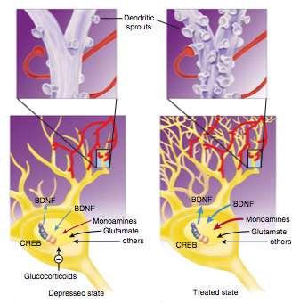 Ipotesi neurotrofica della depressione - Alterazioni dei