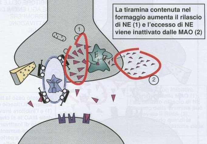 Sindrome