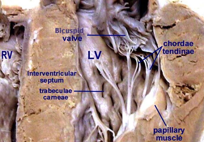 Anche nel ventricolo sx la superficie interna è irregolare per la presenza di rilievi, le
