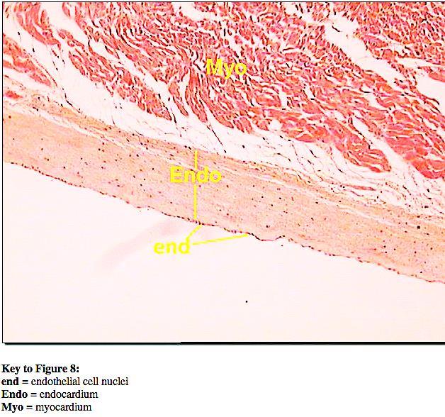 L'ENDOCARDIO riveste le cavità interne del cuore ed è composto di un endotelio e di una