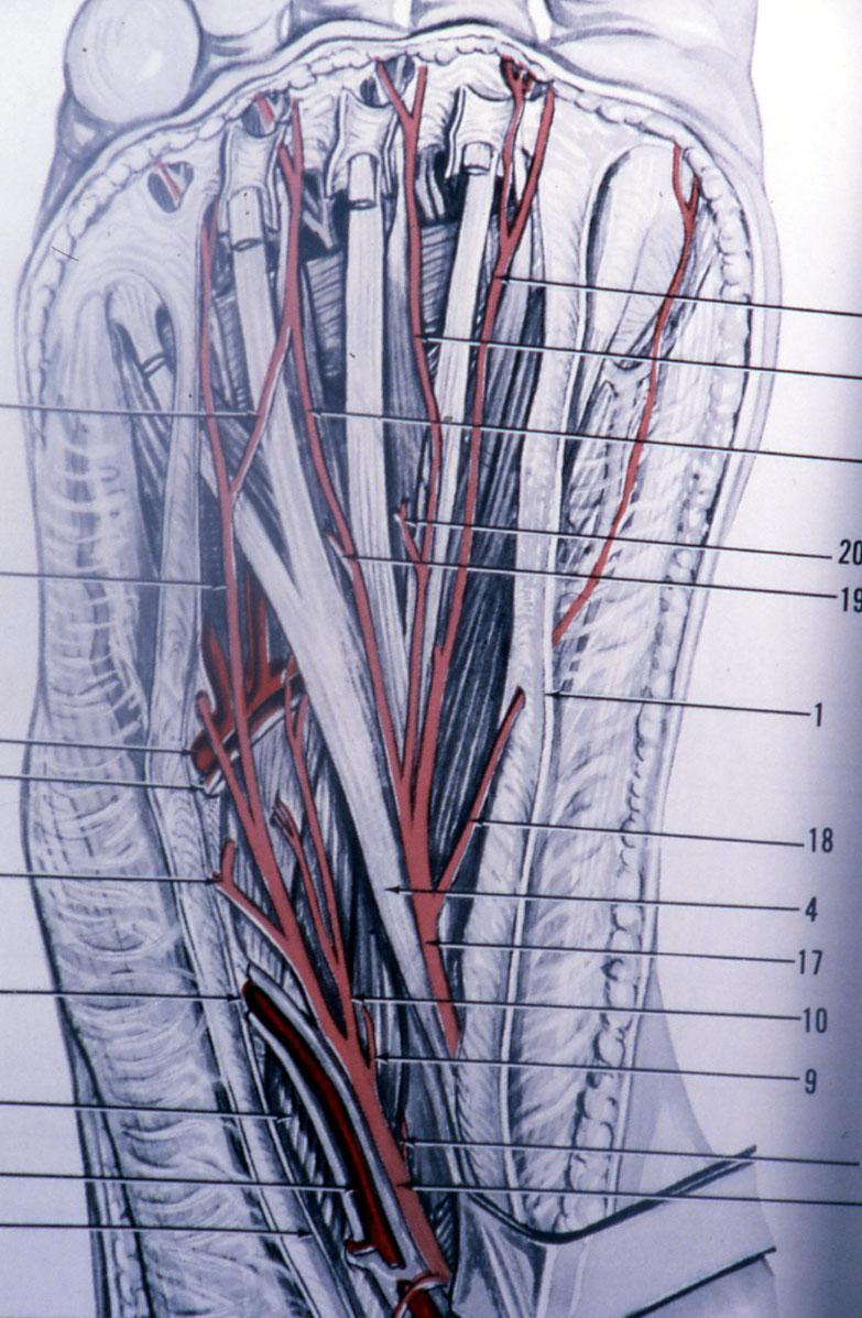 Neuroma di Civinini-Morton Non alterazioni morfologiche Dolore pressorio al III spazio Mulder test +