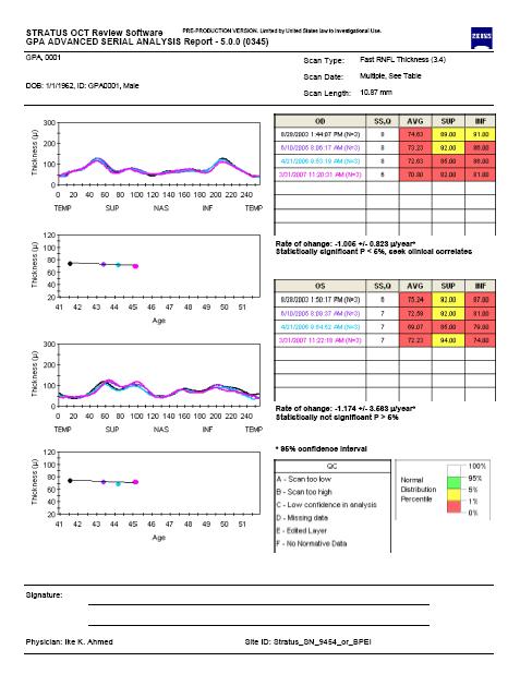 OCT Fibre nervose (RNFL) Spessore RNFL Variazioni spessore RNFL Analisi statistica