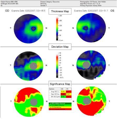 GCC Analysis can sometimes detect damage