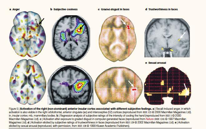 Insula destra anteriore sensazioni soggettive Reintegro delle sensazioni interocettive consente l interpretazione del proprio stato soggettivo Rimappatura delle