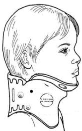 iperestensione della testa, il paziente potrebbe avere lesioni alle vertebre cervicali