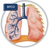 BRONCOPNEUMOPATIA CRONICA OSTRUTTIVA (BPCO) La BPCO è una condizione patologica dell apparato respiratorio caratterizzata da ostruzione del flusso aereo, cronica e parzialmente reversibile