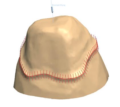 CAPPETTE E PONTI 3SHAPE DENTAL SYSTEM Progettazione avanzata del connettore connettore,