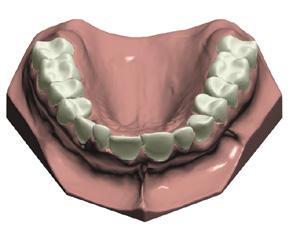 L Orthodontics Upgrade di 3Shape Dental System comprende un applicazione dedicata per la scansione rapida ed accurata di modelli di studio nello scanner D700.