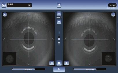 Tecnologia brevettata Wavefront sviluppata da Visionix.