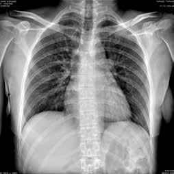 applicazioni di Pronto Soccorso, dal momento che tutti gli esami radiografici possono essere effettuati correttamente, rapidamente e con un unico