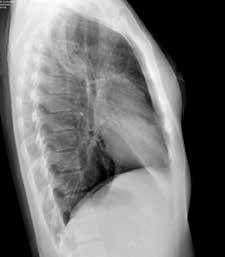 Sempre grazie al Movimento TTT gli esami, sia per radiografia che per fluoroscopia, possono essere eseguiti direttamente sulla barella senza dover