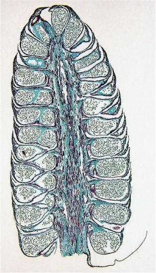 Cono microsporangiato