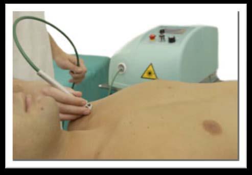 LASER + CRIOTERAPIA = MAGGIORE ENERGIA Flussi di aria fredda secca a - 30 C, intervallati alla stimolazione LASER, provocano