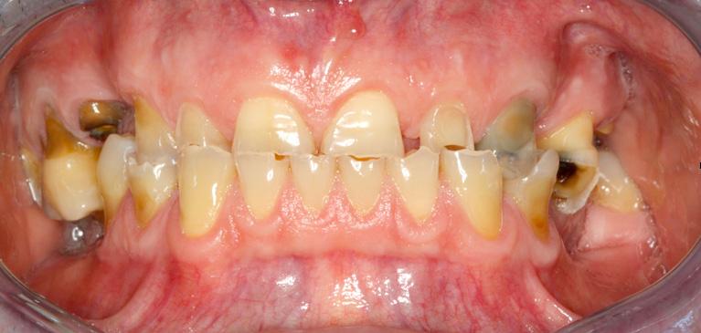 sistematiche f Finalizzazione del caso f La rilevazione del colore CEMENTAZIONE E MICROADATTAMENTO