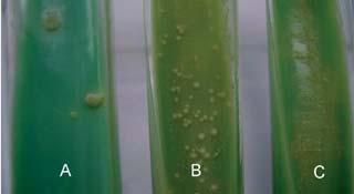 Figura n. 4 crescita di M. tuberculosis (A); M. bovis (B) e M.