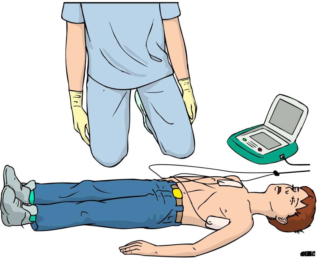 CPR Pediatrico Se l'età è > 8 anni: si usa l'aed dell'adulto.