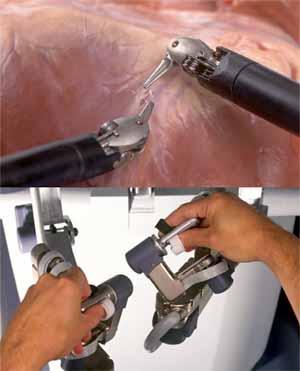 Chirurgia robotica Magnificazione 10x Visione 3D Assenza tremore 7 gradi di libertà Omolateralità del gesto Comfort dell
