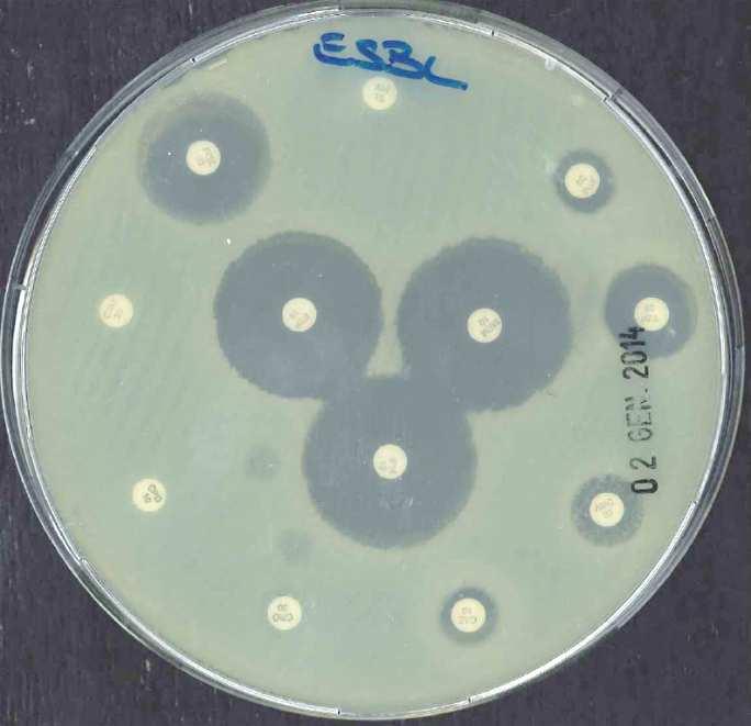 in Pseudomonas e Acinetobacter Alternative