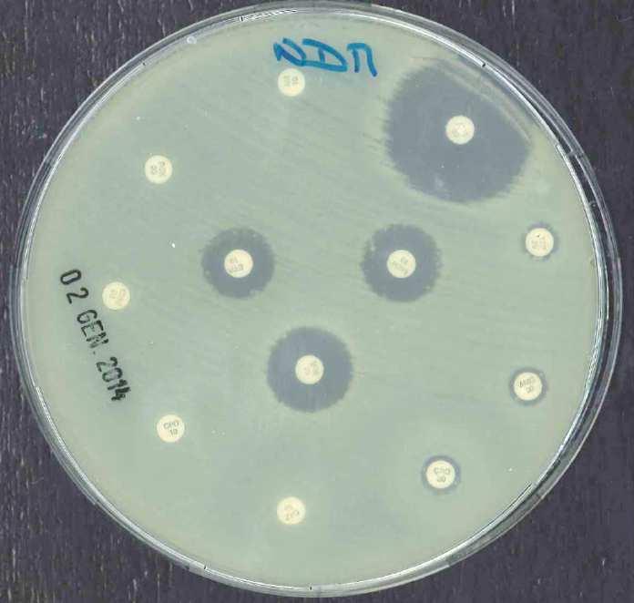 Ceftazidima/Avibactam (Zavicefta, Pfizer;