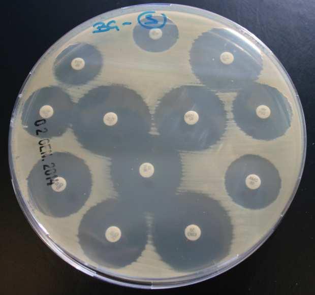 ospedaliero: Klebsiella pneumoniae Dal