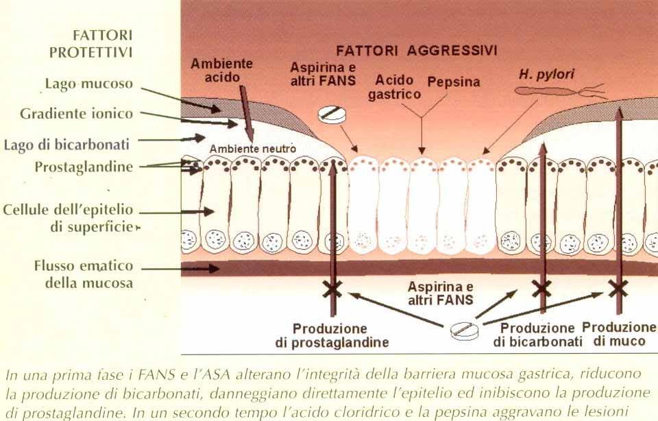 Danno Gastroduodenale