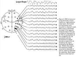 ESEMPIO: LA REGISTRAZIONE EEG 12 REGISTRAZIONE EEG: f s tipica: 256 Hz 12 o 16 bit
