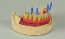 tradizionali tecniche dentali.