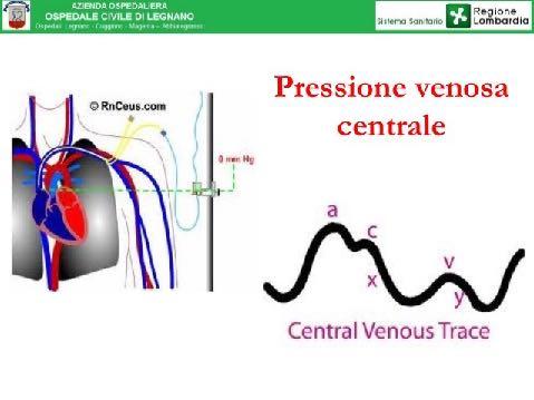 Quando la pressione ventricolare supera quella dell aorta (80 mmhg), si verifica l apertura della valvola aortica e il ventricolo si contrae con accorciamento delle fibre (CONTRAZIONE ISOTONICA),