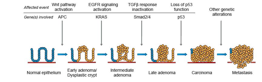 L instabilità cromosomica (CIN) è alla base del modello di progressione del tumore colorettale proposto da Vogelstein et al.