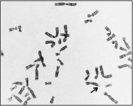 at the end of the X chromosome ( marked by arrow ),