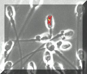 mutazioni delle cellule somatiche possono propagarsi alle cellule figlie Le