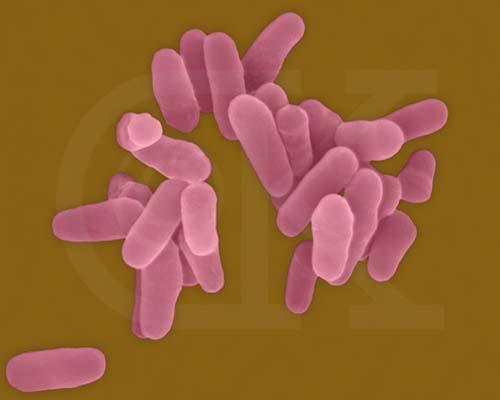 Malattia infettiva provocata da micobatteri in particolare Mycobacterium bovis (bovino e