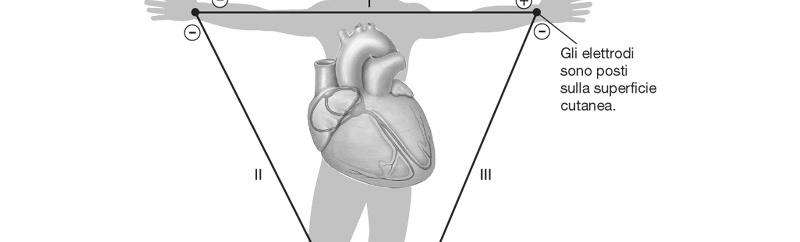 Un elettrocardiogramma, ECG, è la registrazione