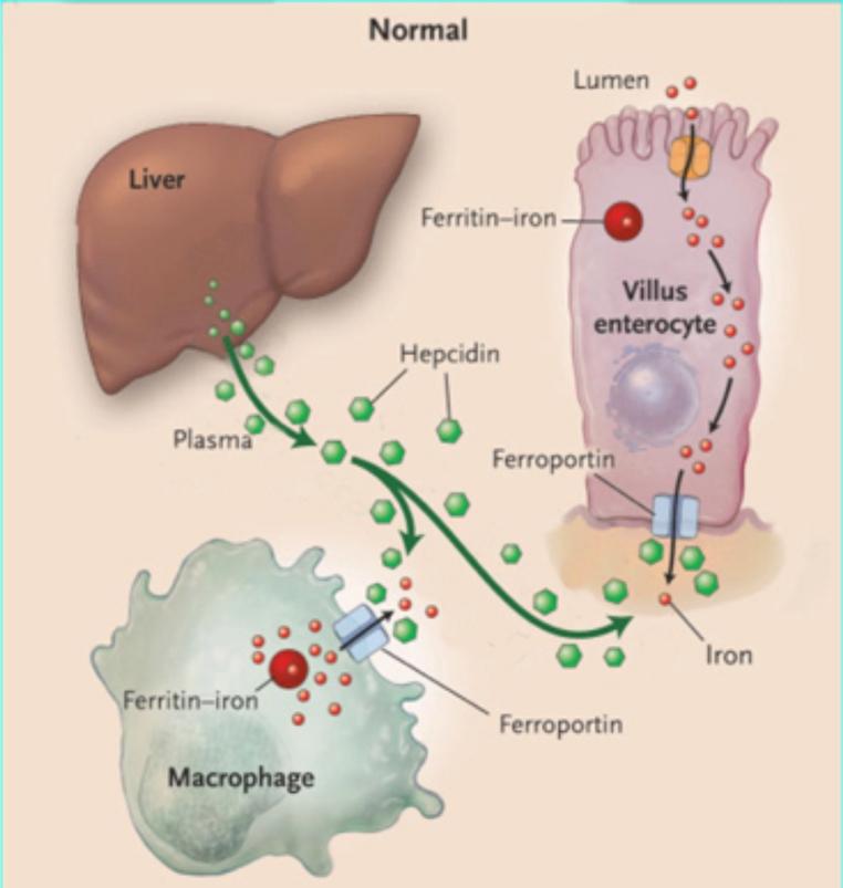 L asse epcidina-ferroportina! A.