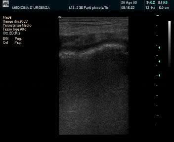 Fecalomi: