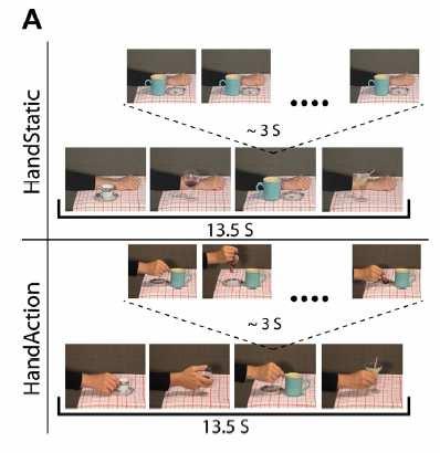 Esp. fmri Soggetti: 16 TD e 2 aplasici 1 Esperimento: Osservazione di atti motori di mano e della mano