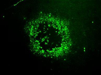 Immunofluorescenza Immunofluorescenza indiretta su sezioni di tessuto PCR da estratto di