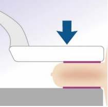 Stessa forza applicata a differenti aree di contatto diversa pressione esercitata Ci sono molti studi in corso il cui obiettivo è quello di determinare quale