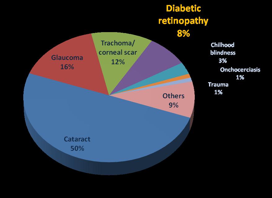 Retinopatia Diabetica E la complicanza microvascolare più comune del DM 4 causa di