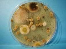 fase di bio-ossidazione: i batteri, i funghi e le muffe, in presenza di ossigeno e di umidità, attaccano il materiale organico, degradando proteine, zuccheri e grassi in modo aerobico: è necessaria