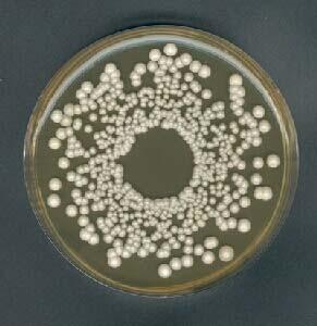 EREDITA MITOCONDRIALE Mutante petite in lievito (Saccharomyces cerevisiae) Assenza enzimi per degradazione glucosio (il gene è