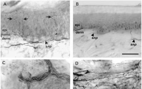 EFFETTI DEL DIABETE MELLITO TIPO 2 SULL INNERVAZIONE EPIDERMICA