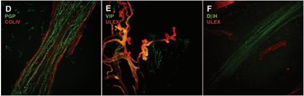 5 (marcatore pan- neuronale) Coll- IV= Collagen type IV (marker for basal lamina) Ulex= Ulex europaeus agglutinin I (marcatore delle glicoproteine e,