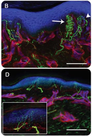 5 (marker for peripheral nerve fibers of all types) Coll- IV= Collagen type IV (marker for basal lamina) Ulex= Ulex europaeus