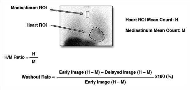 Valutazione della risposta simpatica cardiaca mediante scientifica miocardica con I 123 -MIBG L innervazione adrenergica cardiaca può essere valutata