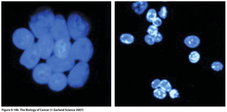 Two lymphocytes