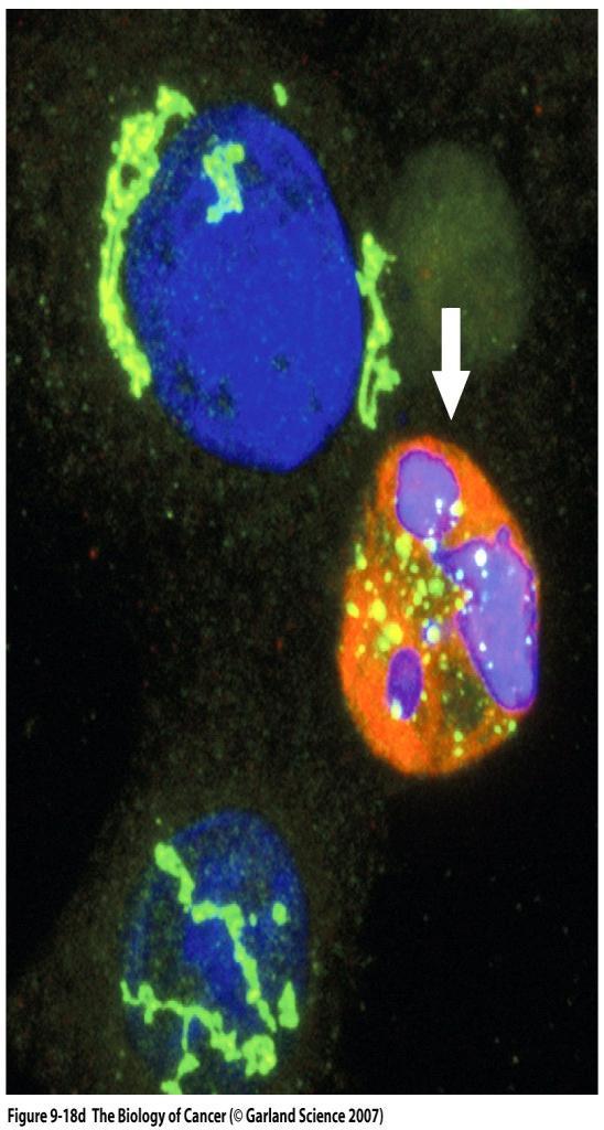 Apoptotic cell