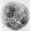 veriformis) cell. (X 18,500.) (Courtesy of Barry S. Fields, Centers for Disease Control.